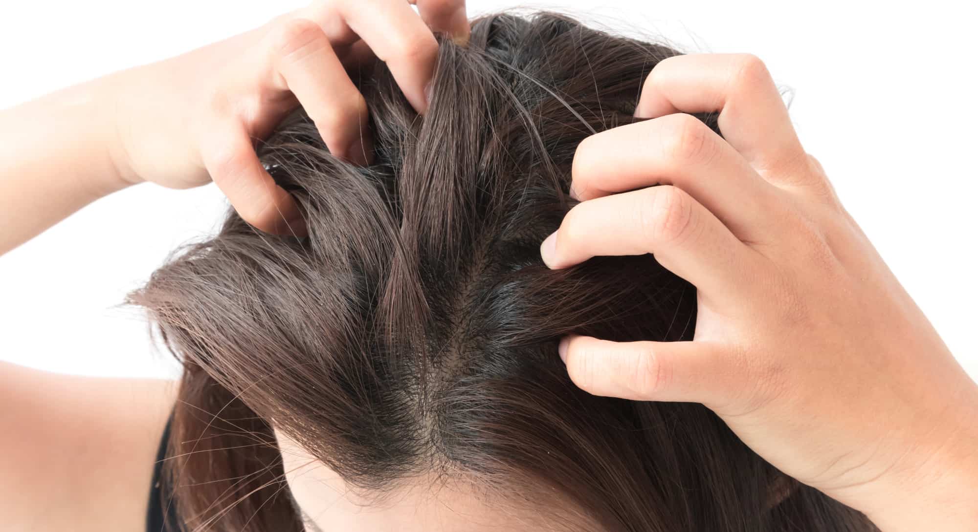 Head Lice Shudders 7